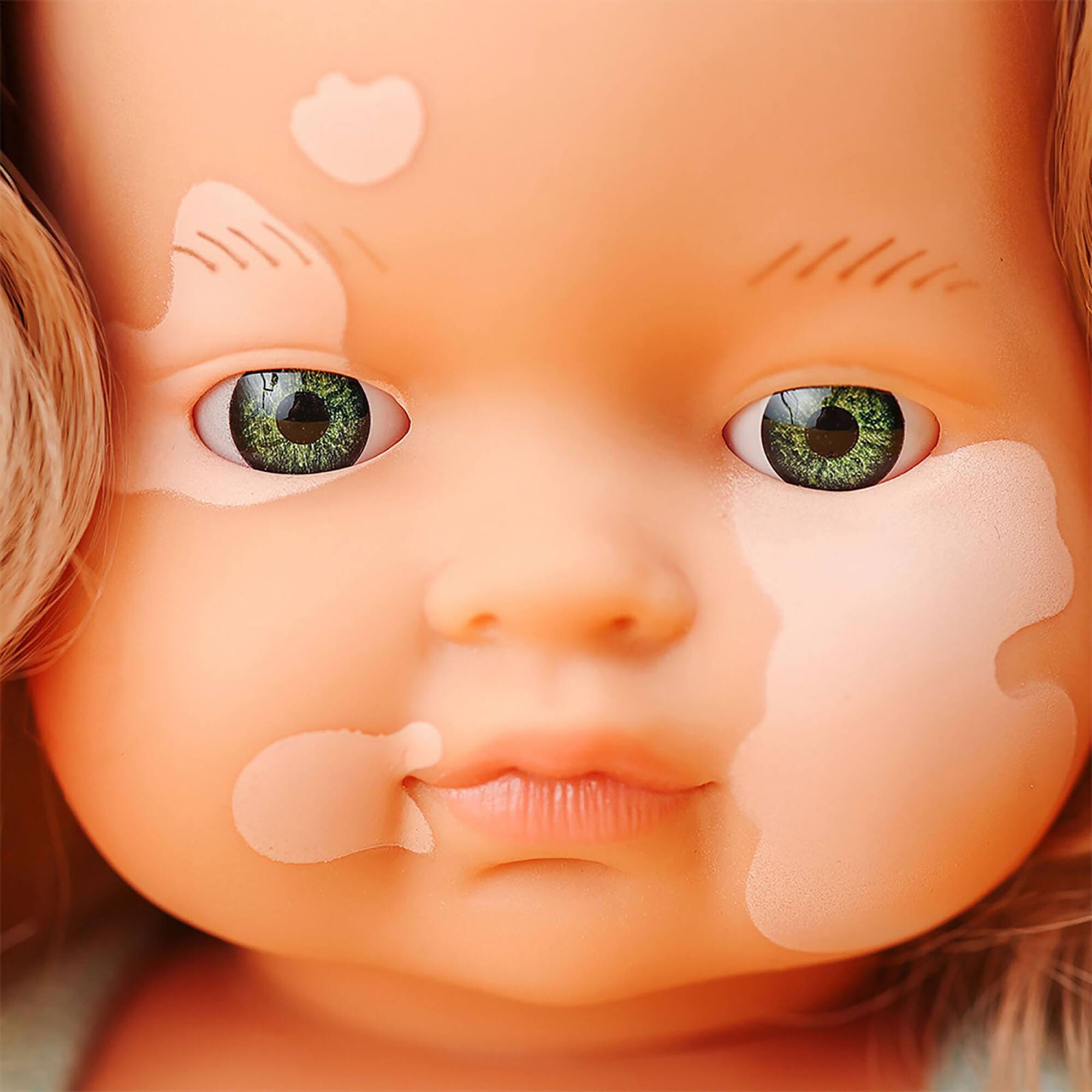 Miniland 15" Anatomically Correct Caucasian Blonde Girl Baby Doll with Vitiligo